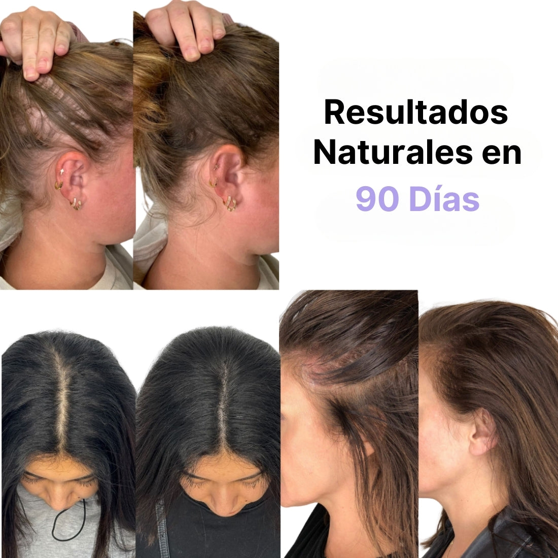 Cepillo de Terapia Capilar 4 en 1 VitaHair® - Estimula, Cuida y Repara Tu Cabello